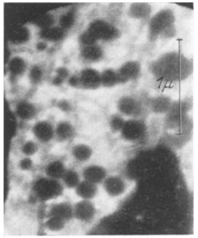 EM-electrograph of Ectromelia-Virus particles.