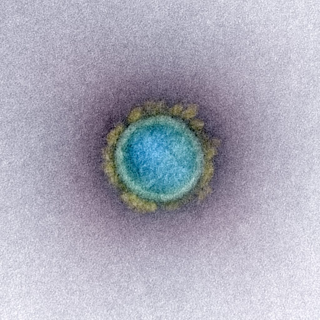 How do we know that Viruses exist? 6